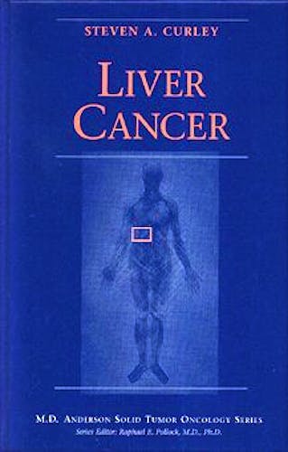 Portada del libro 9780387983707 Liver Cancer