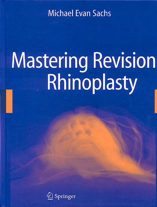 Portada del libro 9780387989044 Mastering Revision Rhinoplasty