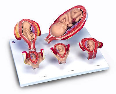 Serie de Embarazo, 5 Modelos