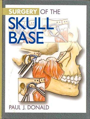 Portada del libro 9780397512898 Surgery of the Skull Base
