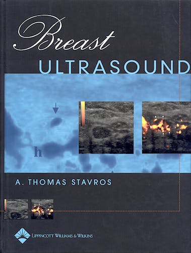 Portada del libro 9780397516247 Breast Ultrasound