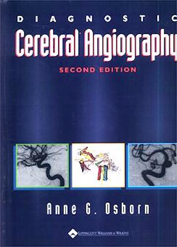 Portada del libro 9780397584048 Diagnostic Cerebral Angiography