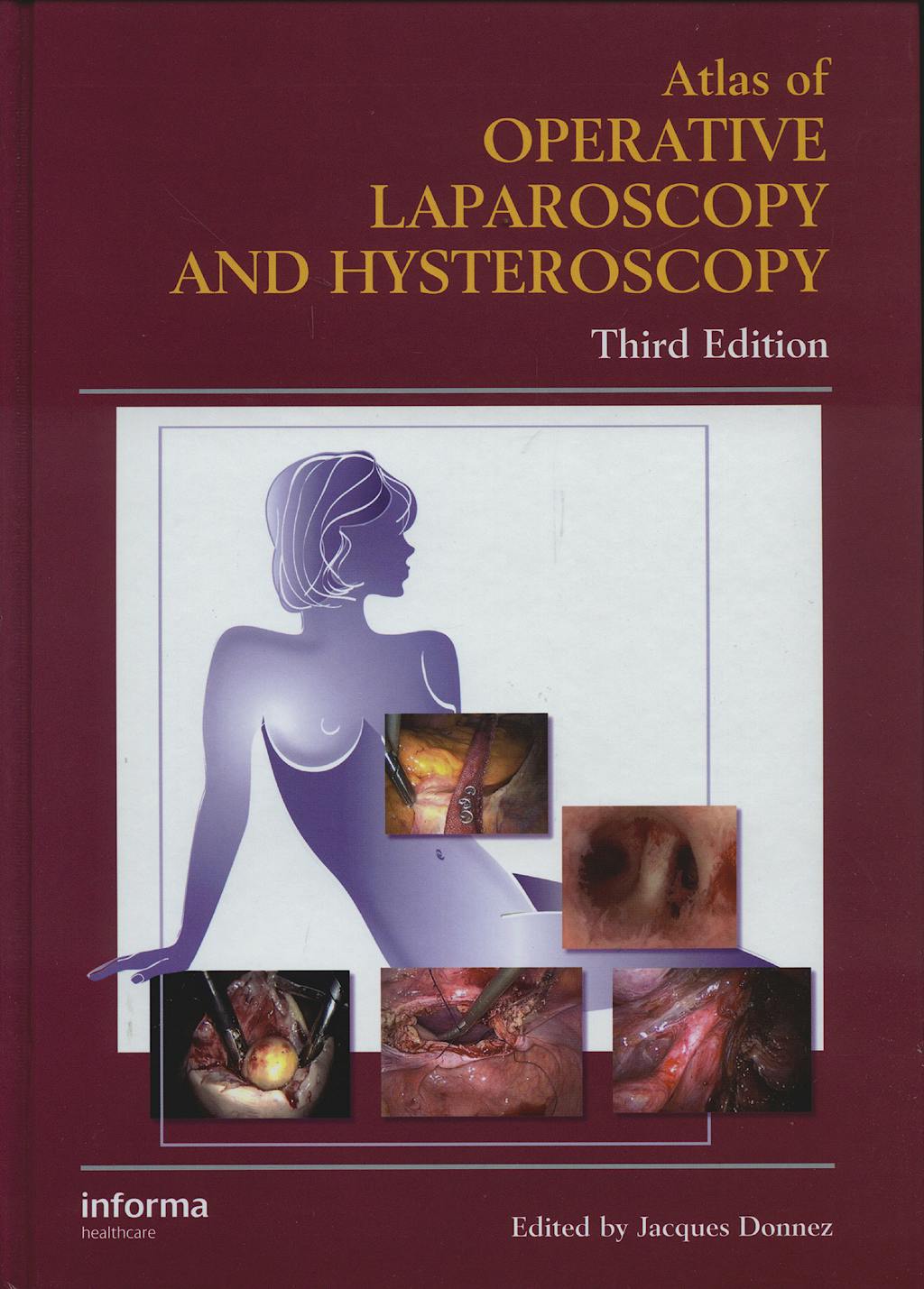 Portada del libro 9780415384155 Atlas of Operative Laparoscopy and Hysteroscopy