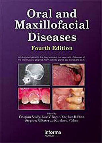 Portada del libro 9780415414944 Oral and Maxillofacial Diseases