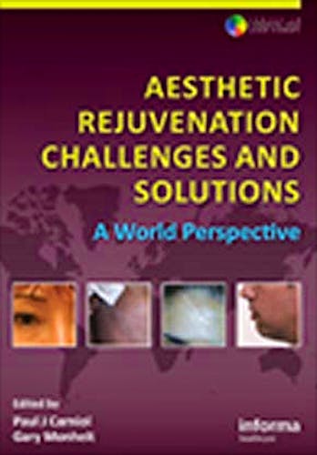 Portada del libro 9780415475600 Aesthetic Rejuvenation Challenges and Solutions. a World Perspective