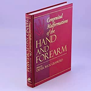 Portada del libro 9780443035609 Congenital Malformations of the Hand and Forearm