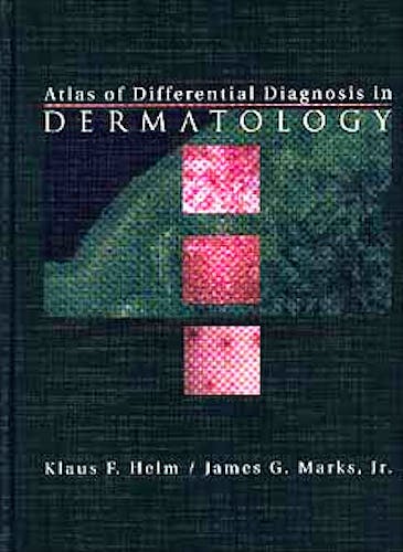 Portada del libro 9780443056055 Atlas of Differential Diagnosis in Dermatology
