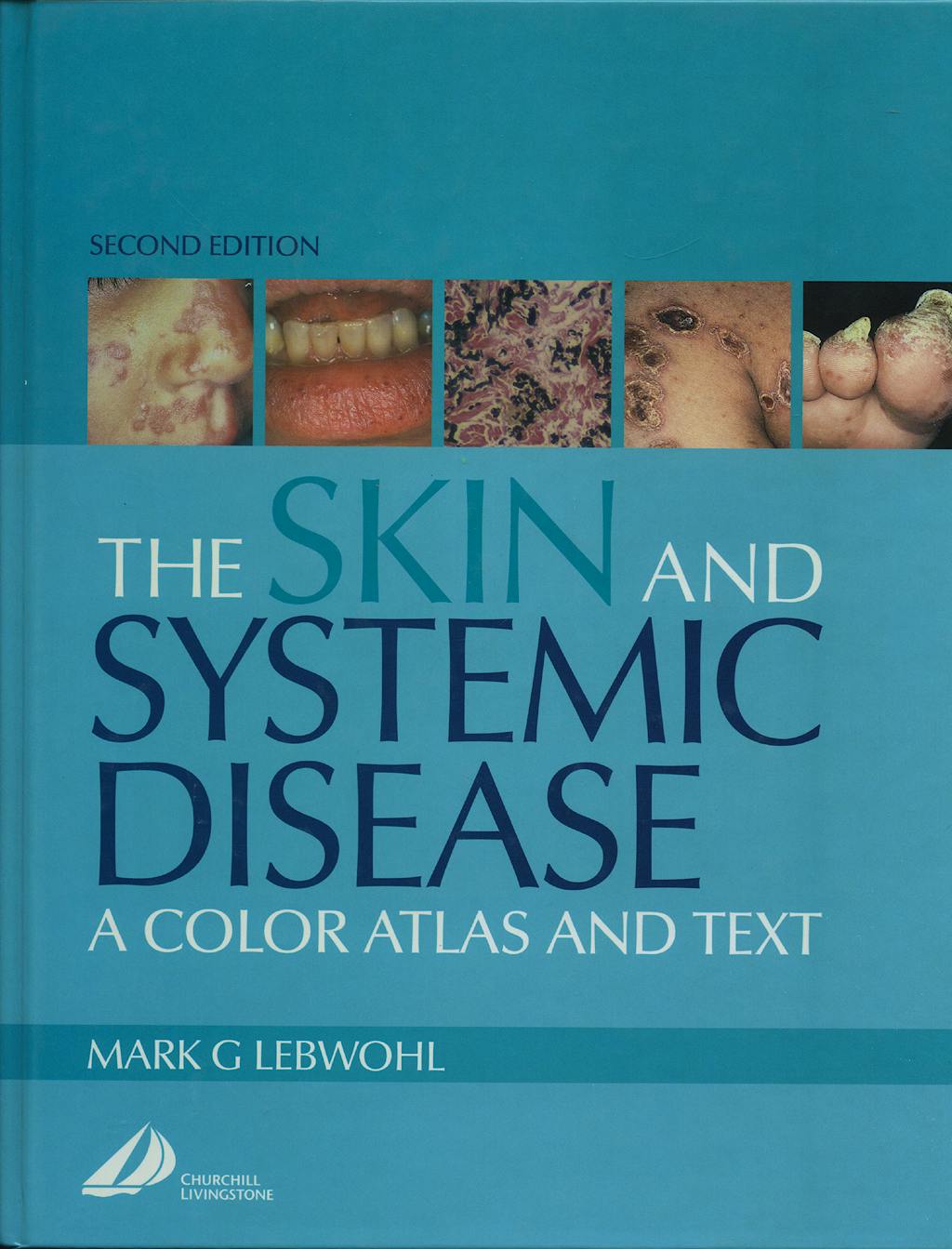 Portada del libro 9780443065392 The Skin and Systemic Disease: A Color Atlas and Text