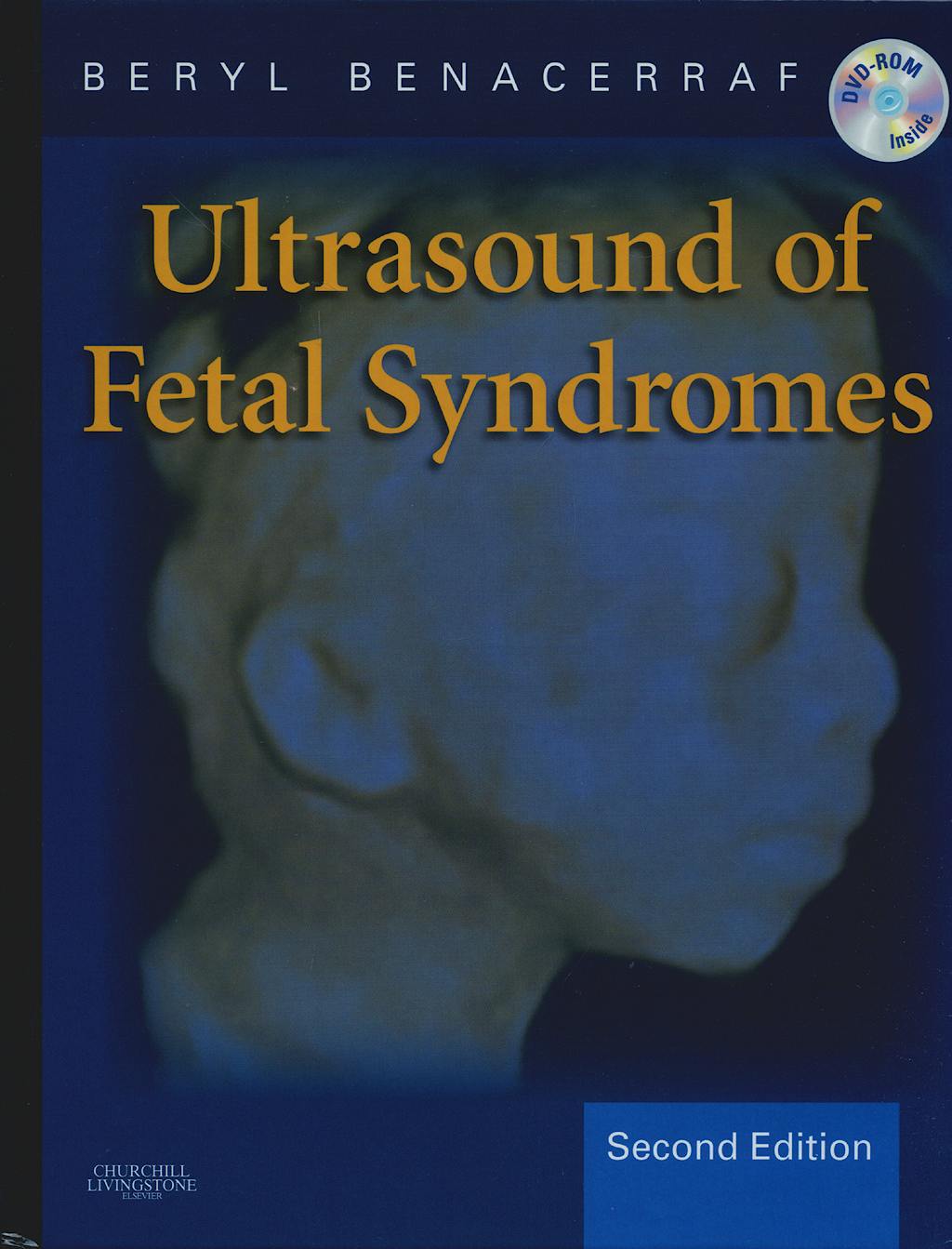 Portada del libro 9780443066412 Ultrasound of Fetal Syndromes
