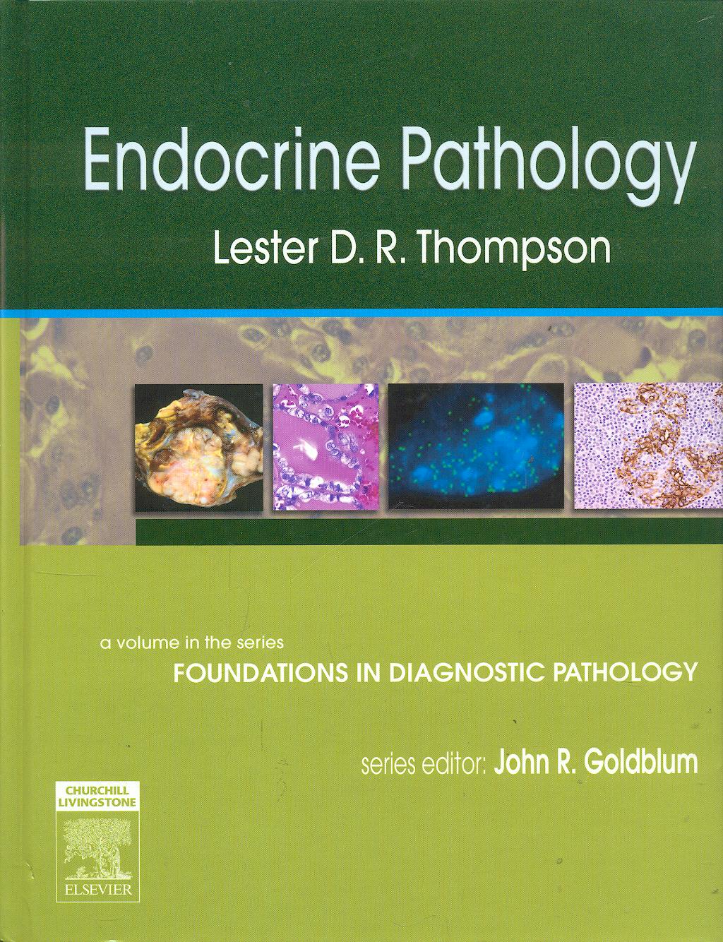 Portada del libro 9780443066856 Endocrine Pathology