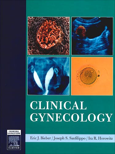 Portada del libro 9780443066917 Clinical Gynecology