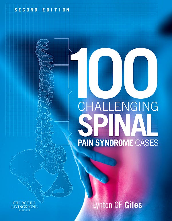 Portada del libro 9780443067167 100 Challenging Spinal Pain Syndrome Cases