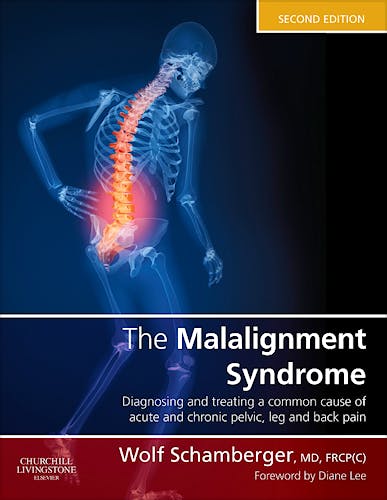 Portada del libro 9780443069291 The Malalignment Syndrome. Diagnosis and Treatment of Common Pelvic and Back Pain