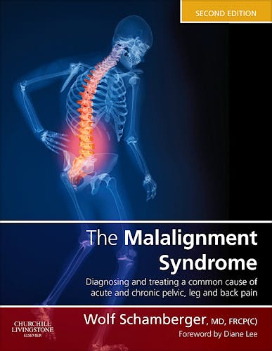 Portada del libro 9780443069291 The Malalignment Syndrome. Diagnosis and Treatment of Common Pelvic and Back Pain