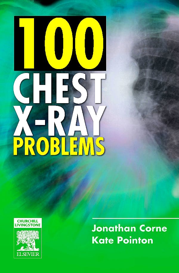 Portada del libro 9780443070129 100 Chest X-Ray Problems