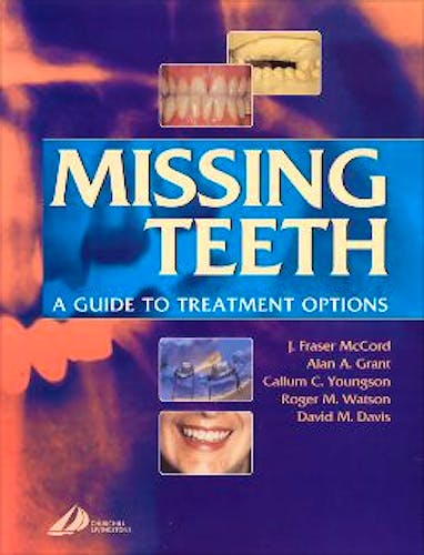 Portada del libro 9780443071539 Missing Teeth. a Guide to Treatment Options