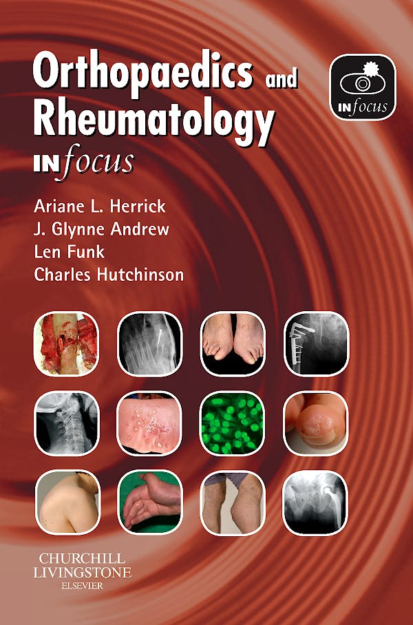 Portada del libro 9780443100864 Orthopaedics and Rheumatology in Focus
