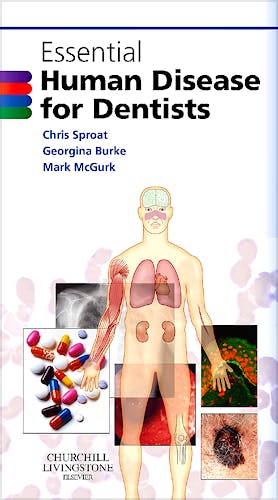 Portada del libro 9780443100987 Essential Human Disease for Dentists
