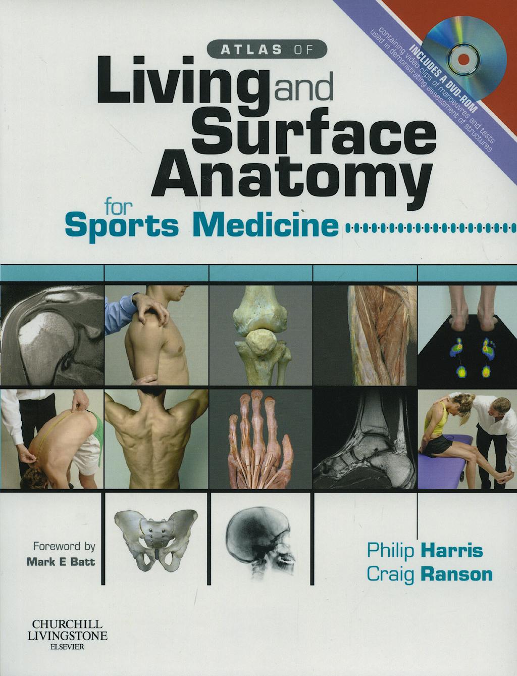 Portada del libro 9780443103162 Atlas of Living and Surface Anatomy for Sports Medicine
