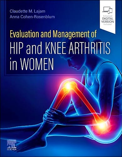 Portada del libro 9780443105593 Evaluation and Management of Hip and Knee Arthritis In Women