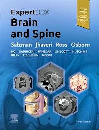 洋書 Expert ddx brain and spine ExpertDDx: Brain and Spine: 9780443106941: Medicine & Health