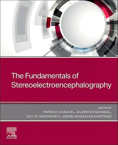 Portada del libro 9780443108778 The Fundamentals of Stereoelectroencephalography