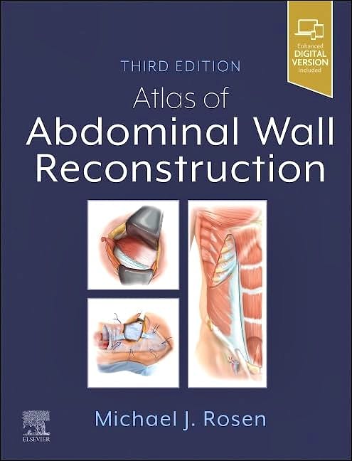 Atlas of Abdominal Wall Reconstruction