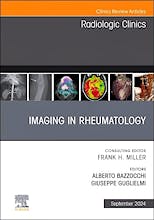 Portada del libro 9780443129353 Imaging In Rheumatology, An Issue Of Radiologic Clinics Of North America (Volume 62-5)