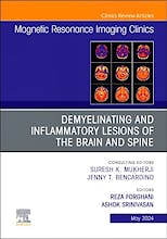Portada del libro 9780443131691 Demyelinating and Inflammatory Lesions of the Brain and Spine. An Issue of Magnetic Resonance Imaging Clinics