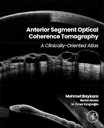 Portada del libro 9780443221057 Anterior Segment Optical Coherence Tomography. A Clinically-Oriented Atlas