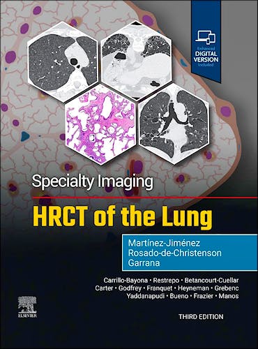 Portada del libro 9780443286360 Specialty Imaging: HRCT of the Lung