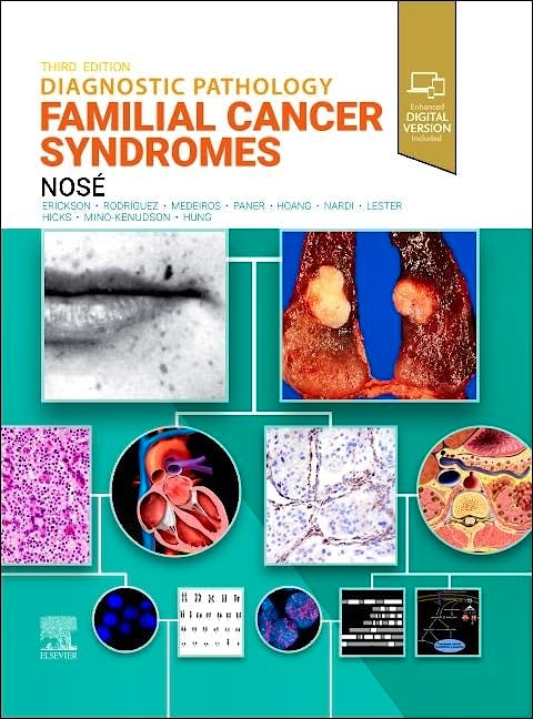 Diagnostic Pathology: Familial Cancer Syndromes