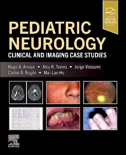 MERRITT's Neurology Review. Print + eBook with Multimedia