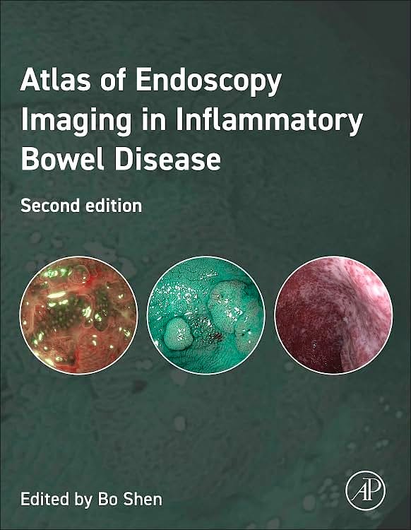 Portada del libro 9780443291722 Atlas of Endoscopy Imaging in Inflammatory Bowel Disease