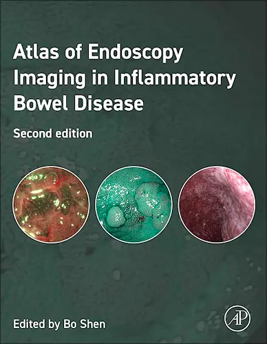 Portada del libro 9780443291722 Atlas of Endoscopy Imaging in Inflammatory Bowel Disease