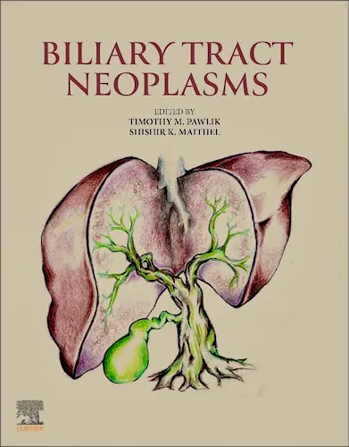 Portada del libro 9780443292873 Biliary Tract Neoplasms