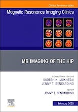Portada del libro 9780443296581 MR Imaging of The Hip, An Issue Of Magnetic Resonance Imaging Clinics Of North America (Volume 33-1)