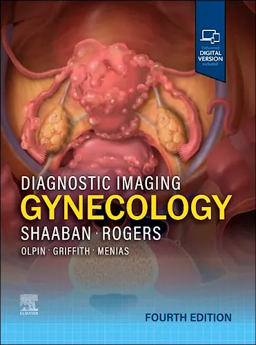 Portada del libro 9780443380396 Diagnostic Imaging: Gynecology