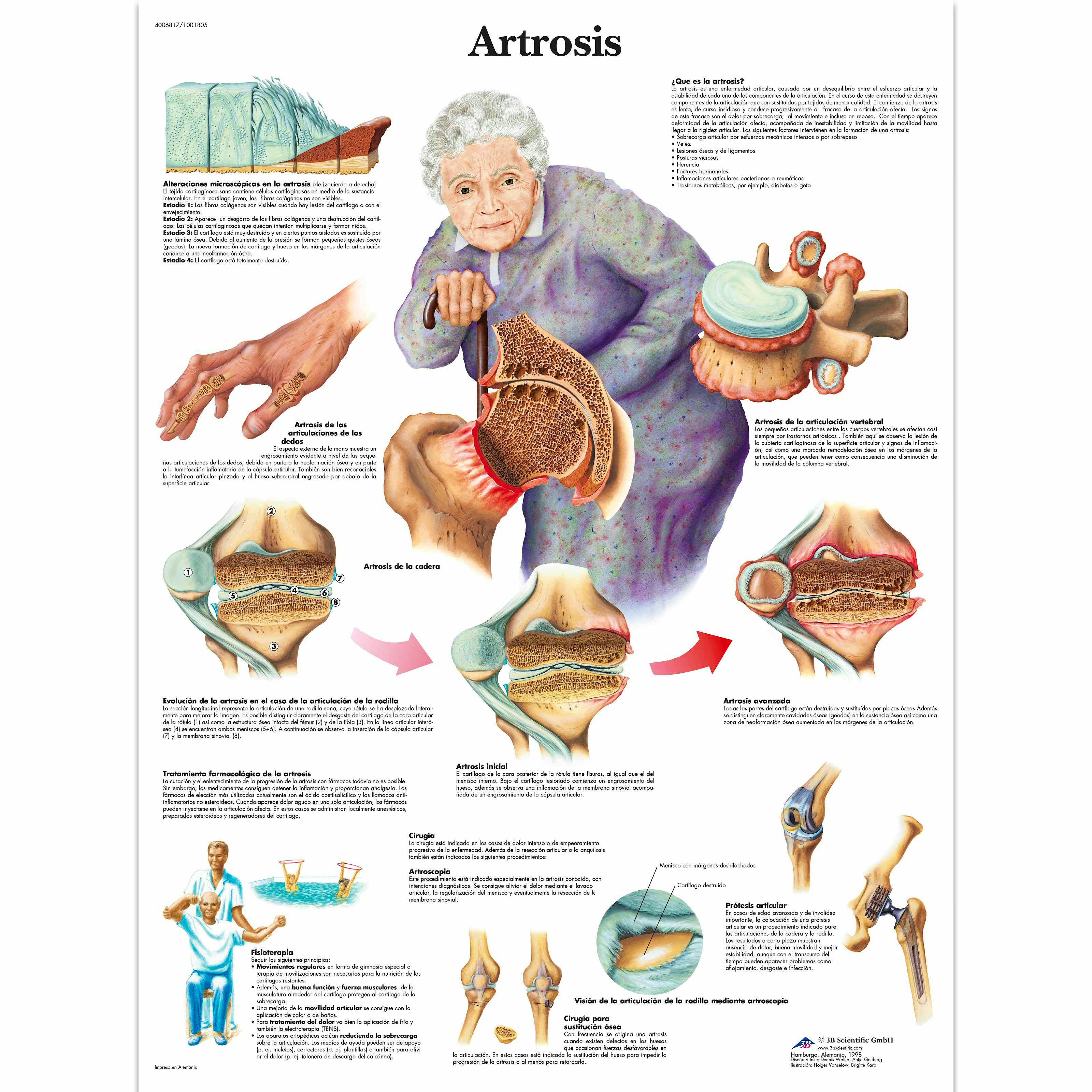 Lamina la Artrosis (formato 50 x 67 cm)