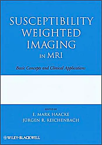 Portada del libro 9780470043431 Susceptibility Weighted Imaging in Mri. Basic Concepts and Clinical Applications