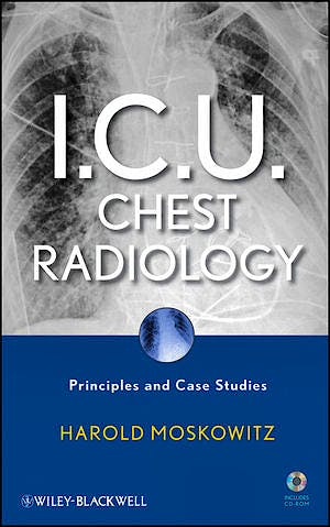 Portada del libro 9780470450345 i.c.u. Chest Radiology + Cd-Rom. Principles and Case Studies