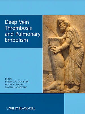 Portada del libro 9780470517178 Deep Vein Thrombosis and Pulmonary Embolism