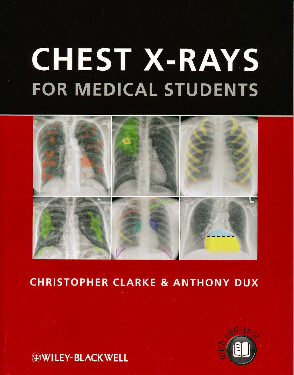Portada del libro 9780470656198 Chest X-Rays for Medical Students