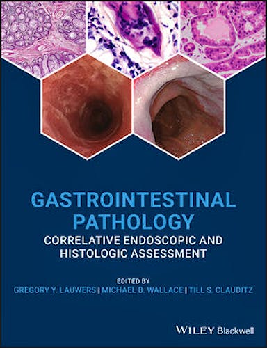 Portada del libro 9780470658369 Gastrointestinal Pathology. Correlative Endoscopic and Histologic Assessment
