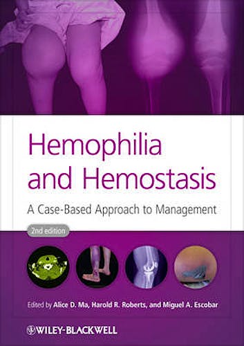 Portada del libro 9780470659762 Hemophilia and Hemostasis. a Case-Based Approach to Management