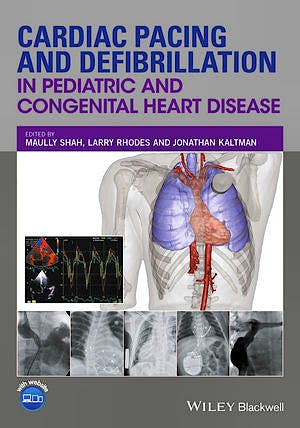 Portada del libro 9780470671092 Cardiac Pacing and Defibrillation in Pediatric and Congenital Heart Disease