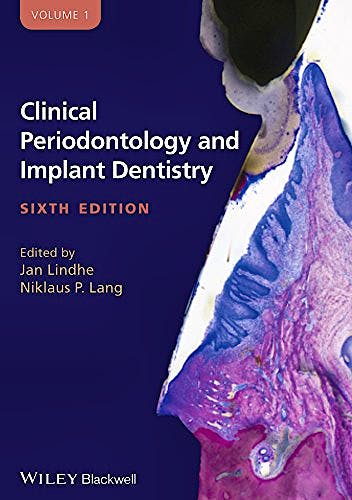Portada del libro 9780470672488 Clinical Periodontology and Implant Dentistry, 2 Vols.