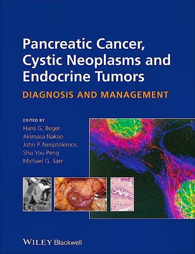 Portada del libro 9780470673188 Pancreatic Cancer, Cystic Neoplasms and Endocrine Tumors. Diagnosis and Management