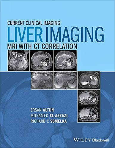 Portada del libro 9780470906255 Liver Imaging. Mri with Ct Correlation
