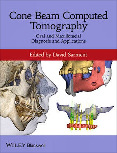 Portada del libro 9780470961407 Cone Beam Computed Tomography: Oral and Maxillofacial Diagnosis and Applications
